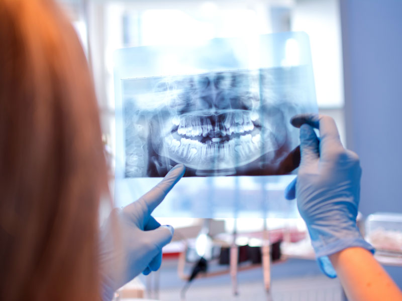 X-Ray